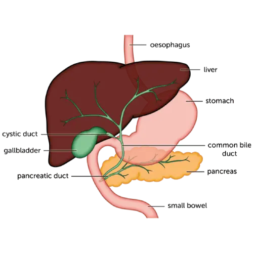 Bile Duct Cance